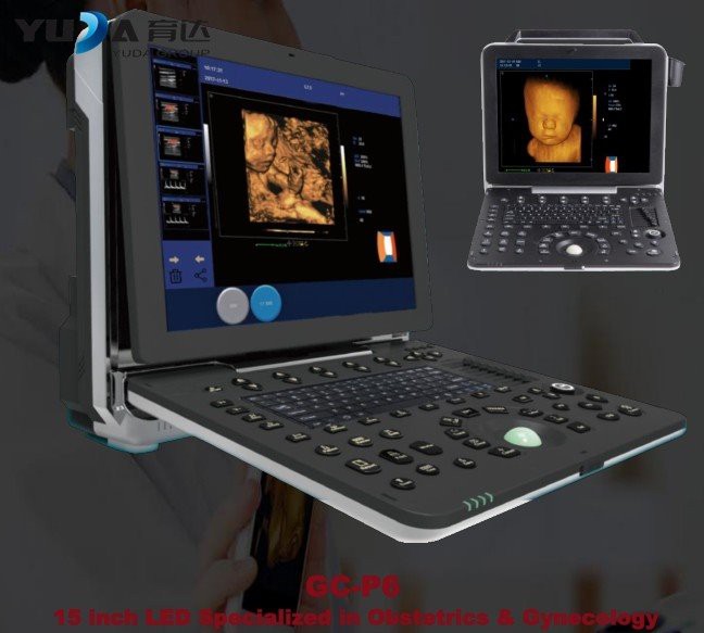 Clinic 15 Inch LCD Portable Laptop Color Ultrasound
