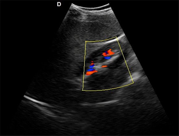 Medical Imaging 4D Doppler Ultrasound