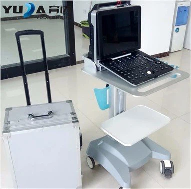 Kulur Doppler Ultrasound Scanner