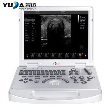 Notebook Skaner Diġitali Sħiħ ultrasound